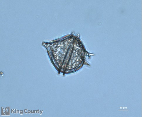 Photo of Protoperidinium pellucidum/Protoperidinium steinii